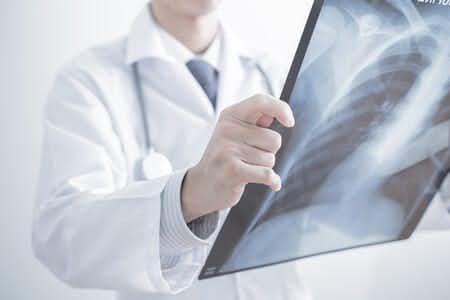 Diagnostic Radiologist Fails To Identify Colorectal Cancer From MR Scan