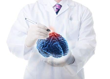 Neurosurgery expert witness opines on subdural hematoma caused by mild brain trauma