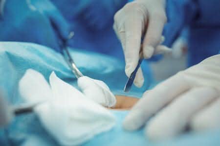 Transplant Surgeon Nicks Patient&#8217;s Ureter Causing Kidney Failure