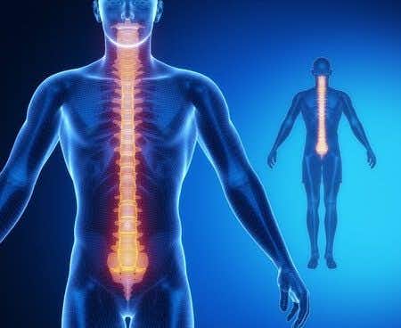 Non-Standard Surgical Technique Causes Chronic Pain for Spinal Fixation Patient