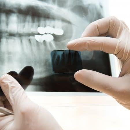 Dental expert advises on failure to diagnose broken jaw