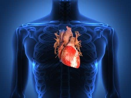 Minimally Invasive Cardiac Surgery Causes Permanent Damage to Man&#8217;s Heart