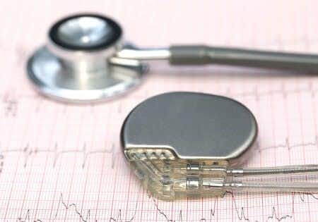 Surgeon Does Not Secure Leads During Pacemaker Placement