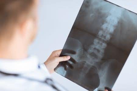 Spinal orthopedic surgery expert witness on advises on post-surgical infection