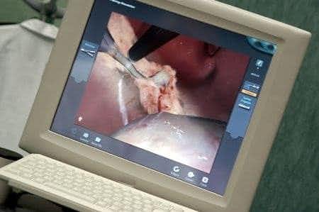 Robotic Surgery Expert Opines on Patient Death from Internal Bleeding