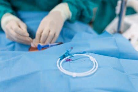 Botched Heart Valve Repair Procedure Leads to Patient Death