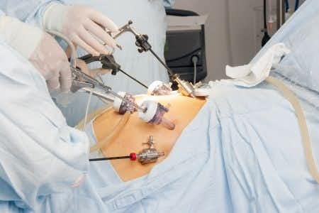 Patient is Severely Injured During Laparoscopic Hysterectomy