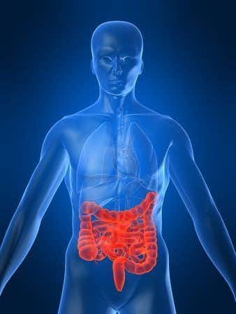 Missed Diagnosis of Bowel Ischemia Results in Death