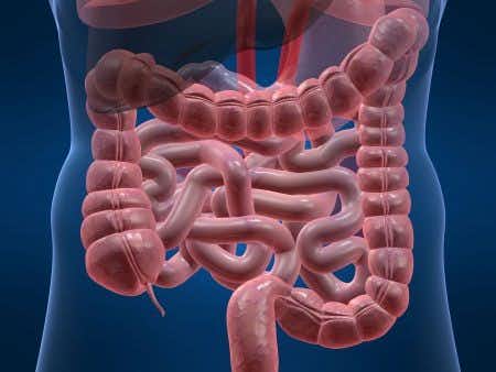 Delayed diagnosis of an incarcerated Spigelian leads to small bowel necrosis