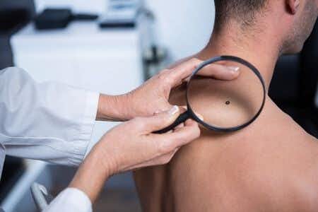 Dermatologist Fails To Conduct Biopsy For Patient With Melanoma Symptoms